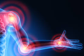 Treatment of Rheumatic Diseases