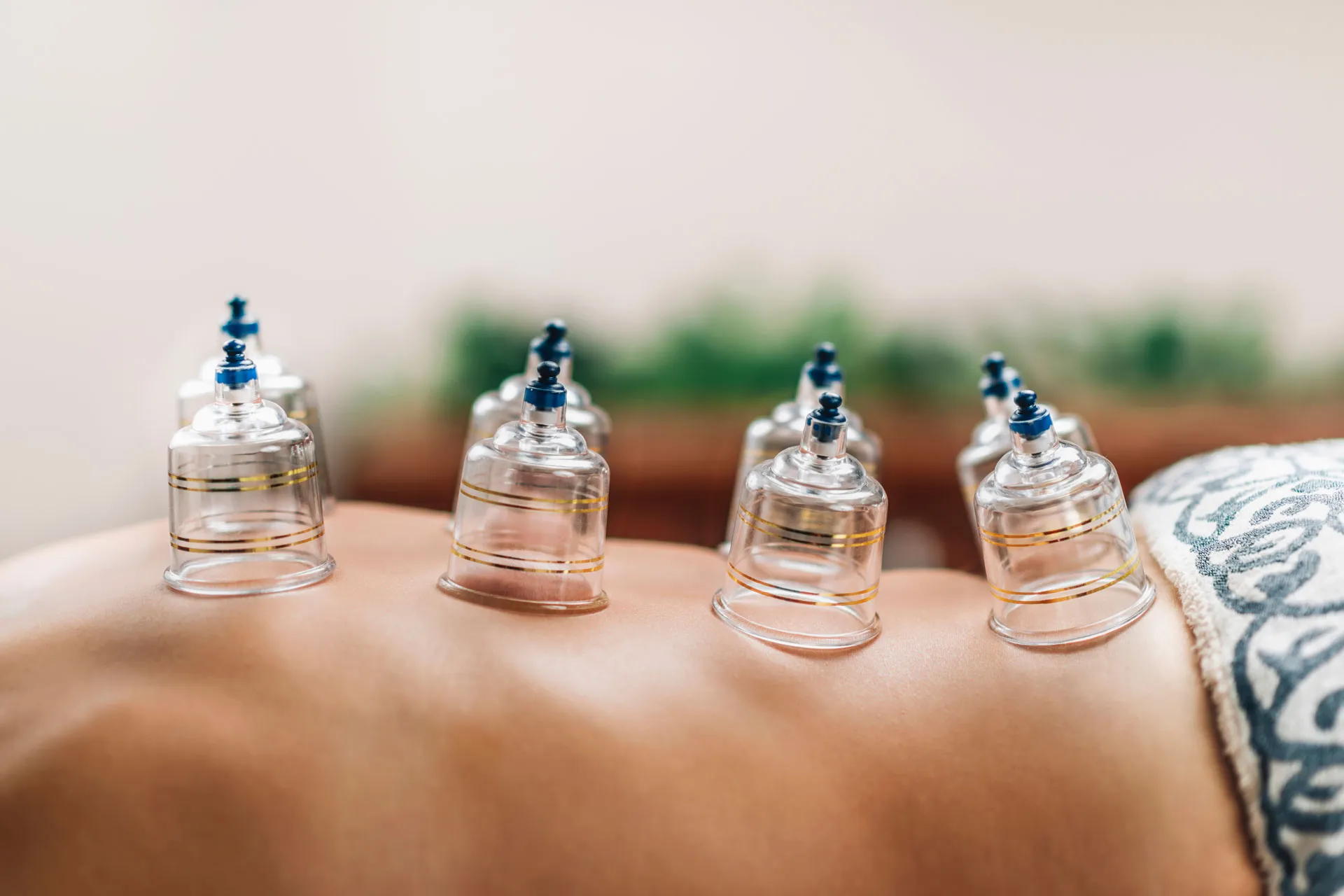 Traitement de hijama traditionnel au Centre Berrada